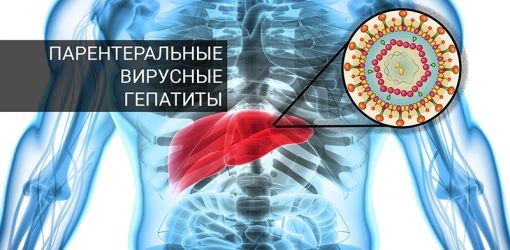 Парентеральные вирусные гепатиты (ПВГ)